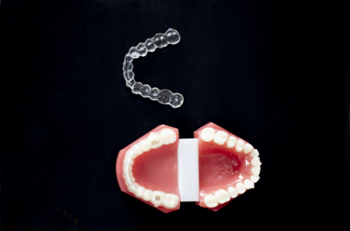 The Evolution of Orthodontics: Say Goodbye to Traditional Braces