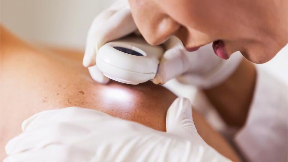 How To Get the Best Treatment at Skin Cancer Clinics in Melbourne?